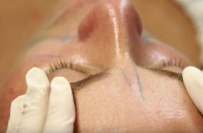 Técnicas para  Rejuvenecer