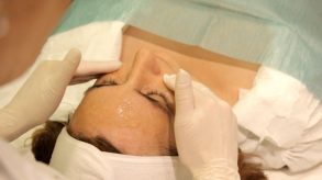 Peeling Químico: Temores infundados