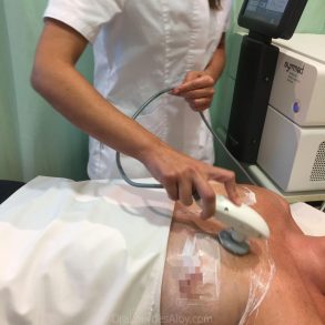 Pechos caídos, tratamiento con Radiofrecuencia