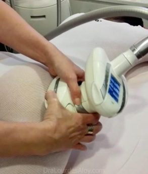 Lipomassage By Endermologie