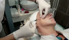 Retoques faciales: ¡Hoy me ha tocado a mi!