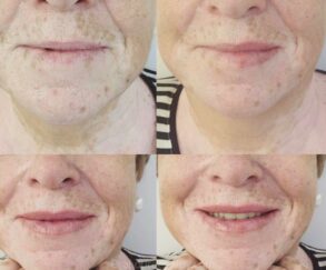 Micropigmentación y Microblading