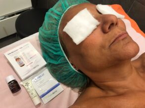 DNA Recovery Peel