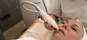 Endermolift