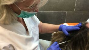 Terapia Regenerativa contra la caída del cabello