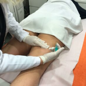 ¿Conoces el tratamiento de la celulitis con ALIDYA?