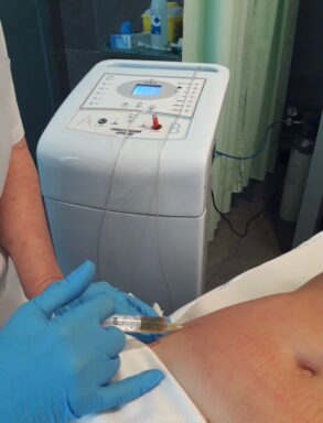 Combatir la celulitis