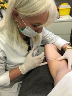 Hiperhidrosis axilar: cuando el sudor se convierte en un problema