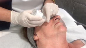 Peeling bioreestructurante